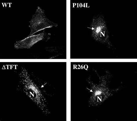 Role of Caveolae and Caveolins in Health and Disease | Physiological Reviews