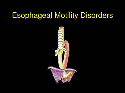 PPT - Esophageal Motility Disorders PowerPoint Presentation, free download - ID:6701046