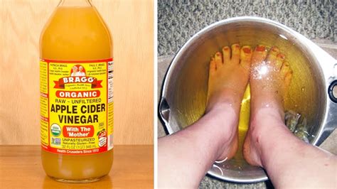 Soak Your Feet In Apple Cider Vinegar, The Results Will Amaze You ...