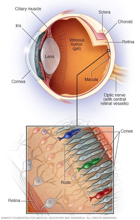 Wet macular degeneration - Symptoms and causes - Mayo Clinic