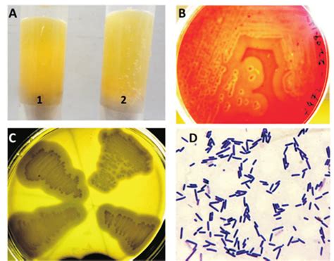 Bacteriological studies of C. perfringens isolate showing (a) rCMM with ...