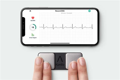 AliveCor Kardia Mobile Personal EKG Overview | Best Buy Blog