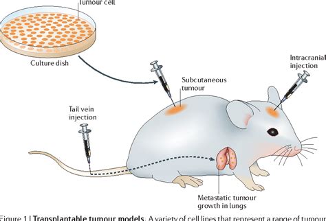 Experimental mouse tumour models: what can be learnt about human cancer ...