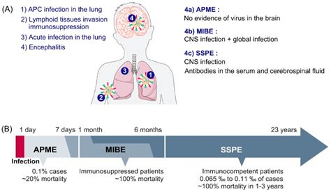 Measles Encephalitis: Towards New Therapeutics. - Abstract - Europe PMC