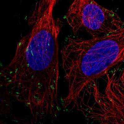 Vinculin Antibodies: Novus Biologicals