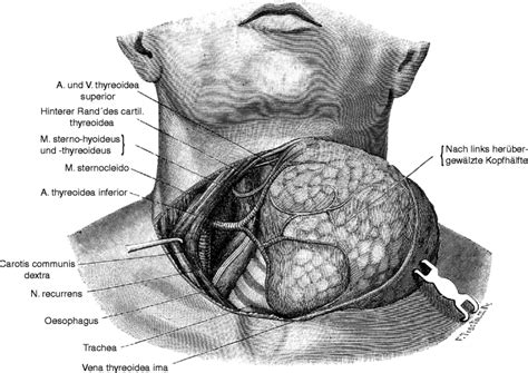 History of Thyroid Surgery: The Kocher Incision | SpringerLink