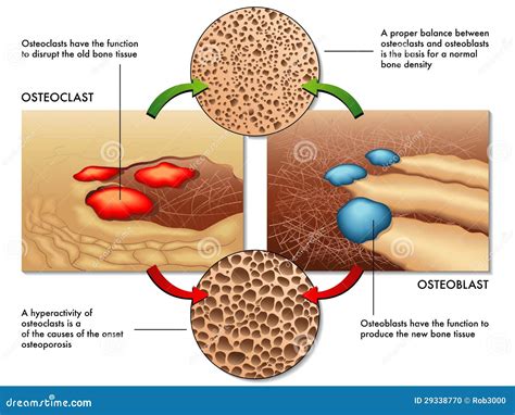 Osteoblast & Osteoclast Stock Photo - Image: 29338770