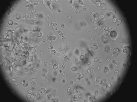 Brettanomyces bruxellensis - Alchetron, the free social encyclopedia