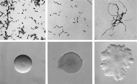 Phylum Firmicutes - Function and Characteristics | Vertebrates and invertebrates, Bacteria ...