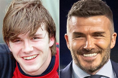 Jurgen Klopp Teeth Before And After - As Simon Cowell Shows Off Gleaming Teeth Other Celebs Who ...