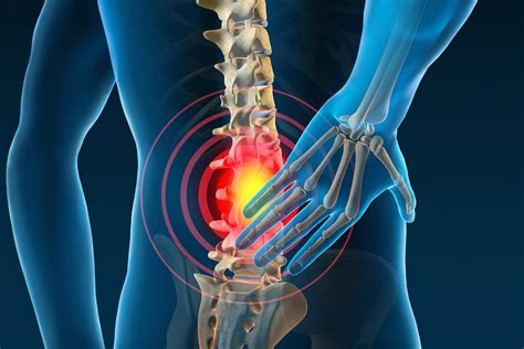 The Effects Of Spinal Decompression For Lumbar Disc Herniation - El ...