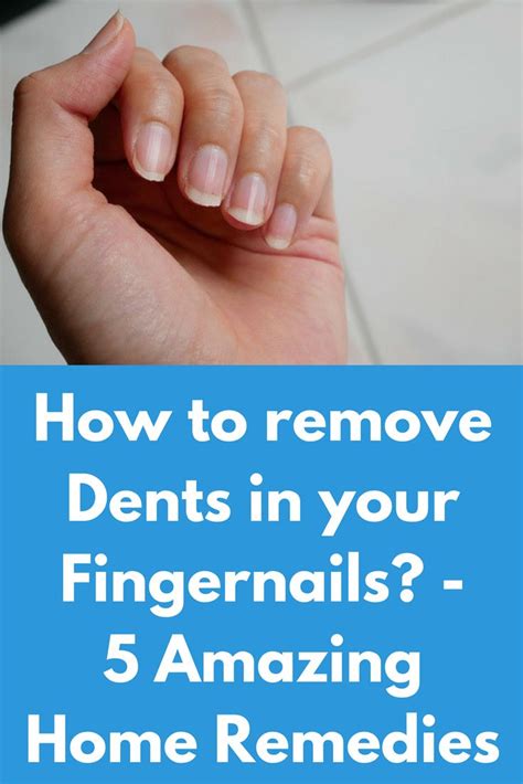 How to remove Dents in your Fingernails? - 5 Amazing Home Remedies ...