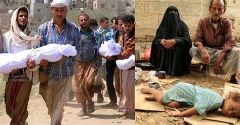 'Over 10 million face acute food shortages in Yemen' | Pressmediaofindia