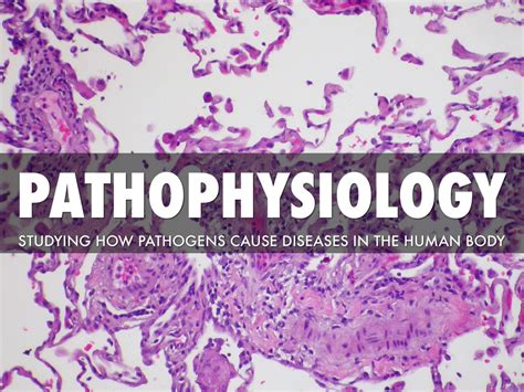 Pathophysiology by Danielle White