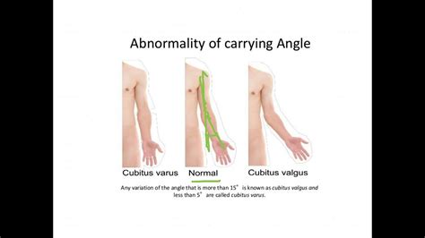 Carrying Angle of the Elbow Joint ELBOW COMPLEX - YouTube