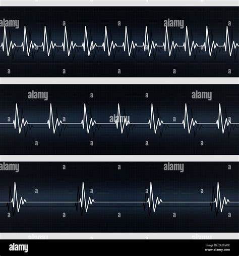 Normal heartbeat hi-res stock photography and images - Alamy