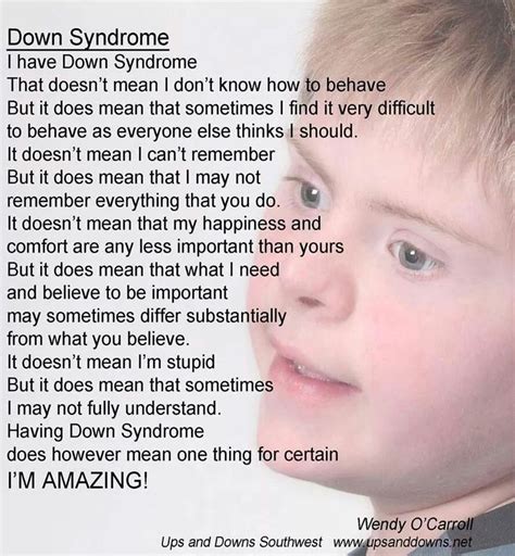 133 best Down Syndrome Awareness images on Pinterest | Beautiful ...