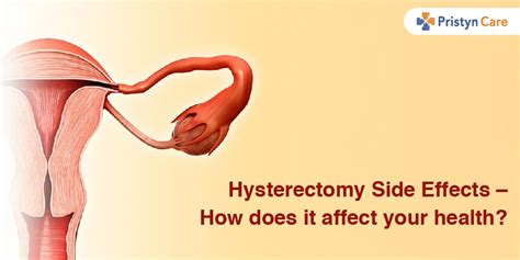 Hysterectomy - Side Effects