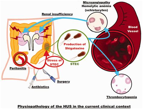 Uremic Syndrome