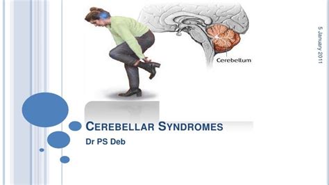 Cerebellar syndromes