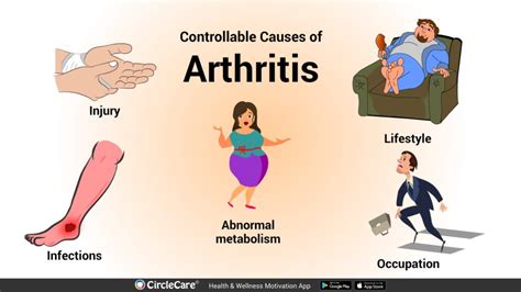 What are the major causes of Arthritis? | CircleCare