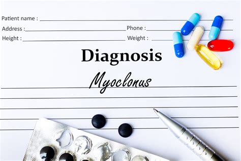 Myoclonus – Causes, Symptoms and Treatment - Apollo Hospitals