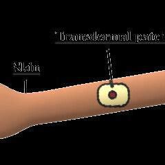 Illustration of administration of the transdermal patch on the surface ...