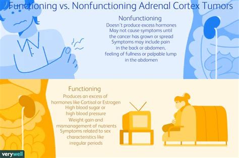 Adrenocortical Carcinoma: Signs, Symptoms, Complications