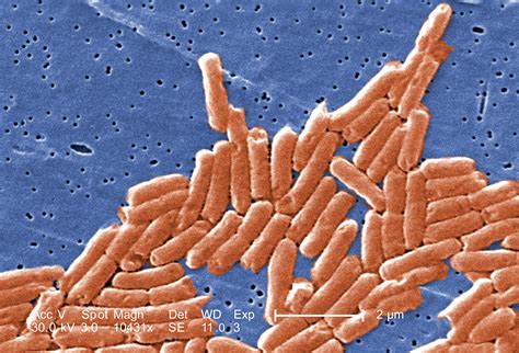 Free picture: gram, negative, bacilli, salmonella, bacteria