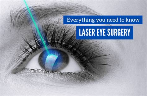 Is Laser Eye Surgery Safe In The Uk? - Queknow