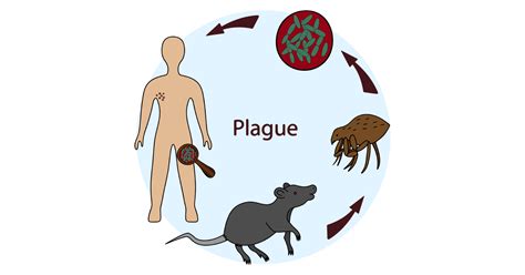 Plague: Types, Symptoms, Causes, Prevention and Treatments