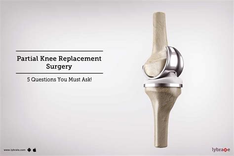 Partial Knee Replacement Procedure