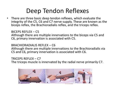 Brachioradialis Reflex