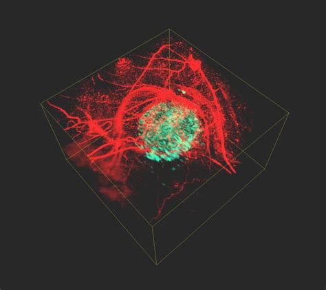 Photoacoustic Imaging: 3D Images of Cancer Cells in the Body - 2018 - Wiley Analytical Science