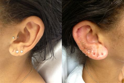 Shattered Cartilage Piercing