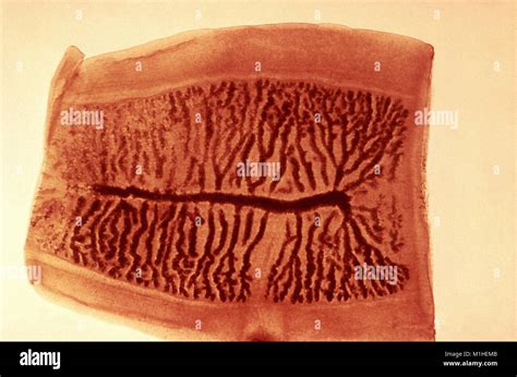 Tapeworm (Taenia saginata) morphology of a gravid proglottid revealed ...