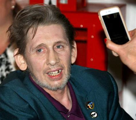 Shane MacGowan's teeth: Before and after transformation | Express.co.uk