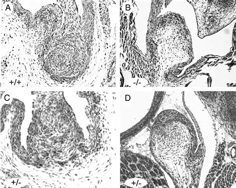 References in The development and anatomy of the gubernaculum in Hoxa11 knockout mice - Journal ...