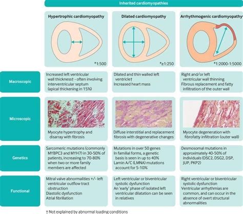 Dilated Cardiomyopathy, Hypertrophic Cardiomyopathy, Nursing Students, Nursing School, Septum ...