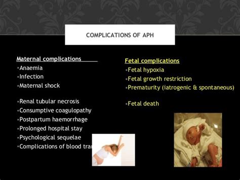 Antepartum hemorrhage