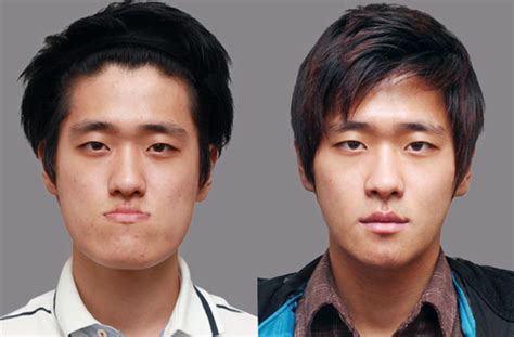 Before and After Photos of Korean Plastic Surgery. Part 2 (62 PICS) - Izismile.com