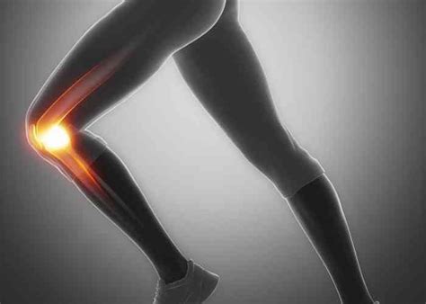 Medial Patellofemoral Ligament Reconstruction | MPFL Injury | Sugar Land, Pearland, Houston, TX