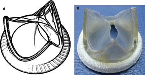 Tissue-Engineered Heart Valve: Future of Cardiac Surgery | SpringerLink