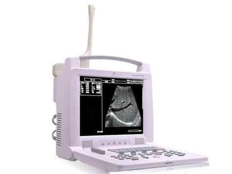 Full Digital Portable Ultrasound Scanner,medical digital ultrasound scanner