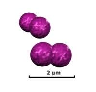 Moraxella catarrhalis pathogenesis - microbewiki