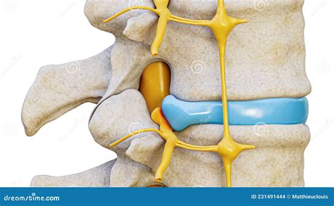 Herniated Disc with Spinal Nerve Compression 3D Rendering Illustration Lateral View Isolated on ...