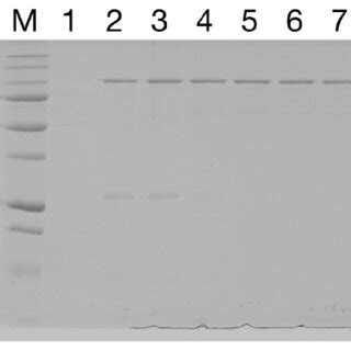 Purification of GST-dark. Lane 1: His-SUMO-GST-dark (eluate after first... | Download Scientific ...