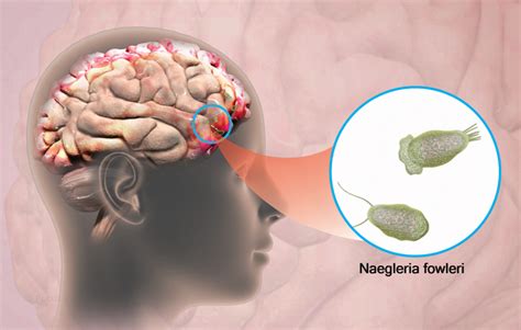 Health Condition : Symptoms, Causes, Treatment and More