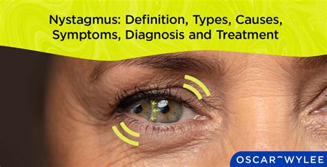 Nystagmus Symptoms Causes Treatment Options Explained - vrogue.co
