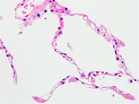 Pathology Outlines - Histology